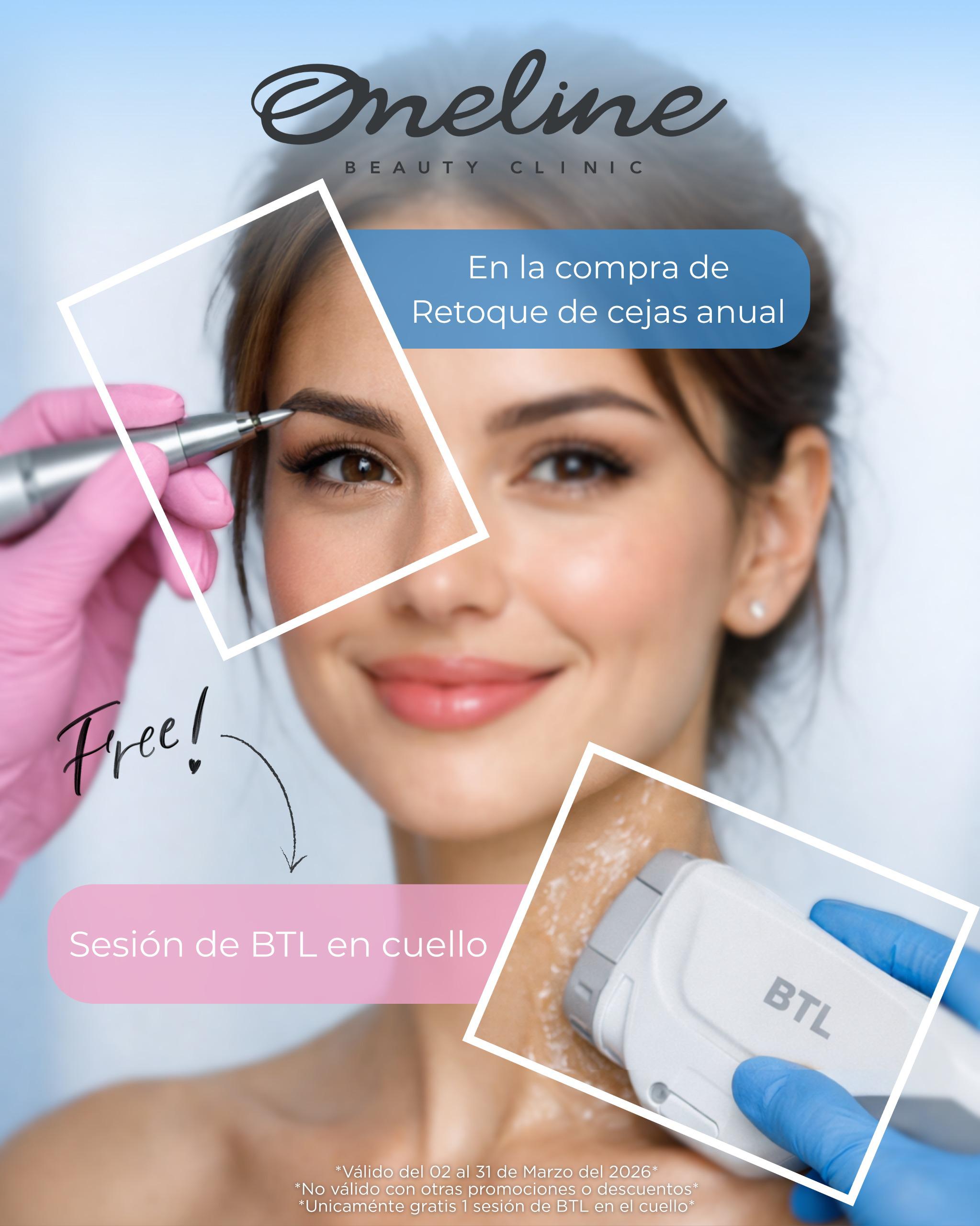 es_WhatsApp Image 2026-03-02 at 12.11.04